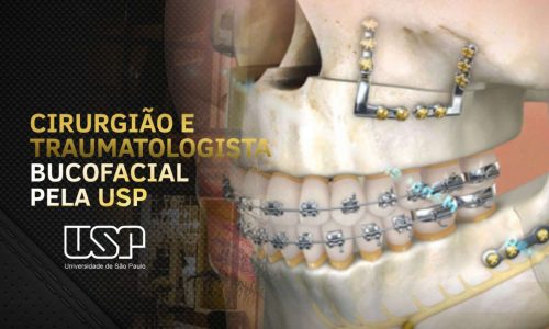 Descobrindo o ápice da cirurgia facial: as últimas tendências e tecnologias