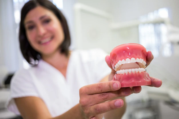 Os diferentes tipos de aparelhos dentários disponíveis em Eunápolis