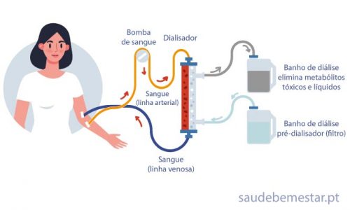Desvendando os Segredos da Diálise: Um Olhar Profundo sobre seu Funcionamento