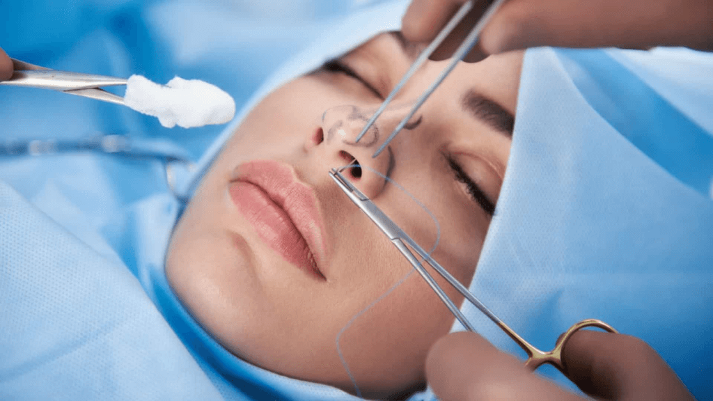  Rinoplastia secundária